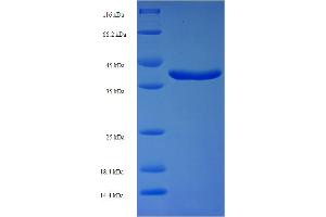 SDS-PAGE (SDS) image for RAB11A, Member RAS Oncogene Family (RAB11A) (AA 2-213) protein (His-SUMO Tag) (ABIN5710201) (RAB11A Protein (AA 2-213) (His-SUMO Tag))