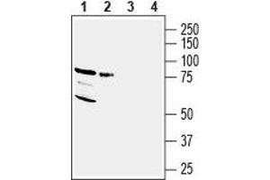 Western blot analysis of human MCF-7 breast adenocarcinoma cell lysate (lanes 1 and 3) and human MDA-MB-231 breast adenocarcinoma cell lysate (lanes 2 and 4): - 1,2. (Neuregulin 3 抗体  (Extracellular, N-Term))