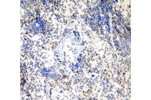 IHC analysis of HP1 gamma using anti-HP1 gamma antibody (ABIN5693033). (CBX3 抗体  (AA 2-183))