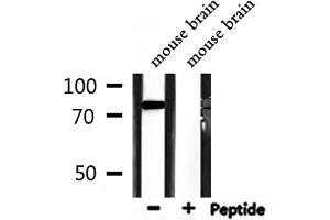 Western blot analysis of extracts from mouse brain, using ATF6B Antibody.