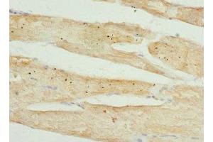 Immunohistochemistry of paraffin-embedded human skeletal muscle tissue using ABIN7173557 at dilution of 1:100 (Tropomodulin 4 抗体  (AA 1-345))
