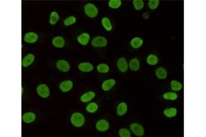 Immunocytochemistry staining of HeLa cells fixed with 4 % Paraformaldehyde and using anti-HP1-gamma mouse mAb (dilution 1:200). (CBX3 抗体)
