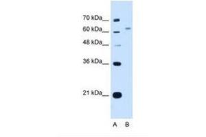 Image no. 1 for anti-WSC Domain Containing 2 (WSCD2) (C-Term) antibody (ABIN341313) (WSCD2 抗体  (C-Term))