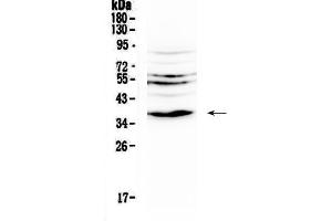 Western blot analysis of IL12B using anti-IL12B antibody . (IL12B 抗体  (AA 23-250))