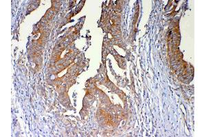 Immunohistochemistry (IHC) image for anti-Dynein, Light Chain, Tctex-Type 1 (DYNLT1) (AA 1-80) antibody (ABIN5693148)