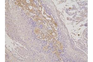 IHC analysis of RBMS3 using anti-RBMS3 antibody (ABIN6719584).