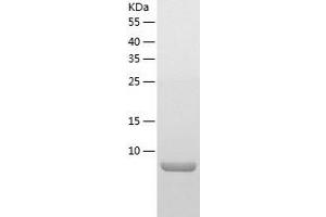Western Blotting (WB) image for Oxidoreductase Like Domain Containing 1 (OXLD1) (AA 46-147) protein (His tag) (ABIN7124288) (OXLD1 Protein (AA 46-147) (His tag))