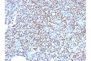 Immunohistochemistry (IHC) image for anti-Spleen Focus Forming Virus (SFFV) Proviral Integration Oncogene Spi1 (SPI1) (AA 16-170) antibody (ABIN6940631)