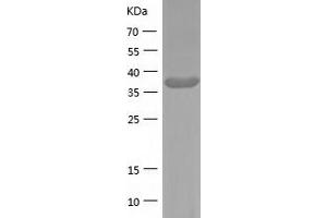 Western Blotting (WB) image for Guanine Nucleotide Binding Protein (G Protein), alpha Inhibiting Activity Polypeptide 2 (GNAI2) (AA 1-355) protein (His tag) (ABIN7123238)