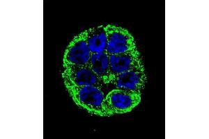 Confocal immunofluorescent analysis of YOD1 Antibody (C-term) (ABIN655251 and ABIN2844850) with WiDr cell followed by Alexa Fluor 488-conjugated goat anti-rabbit lgG (green). (YOD1 抗体  (C-Term))