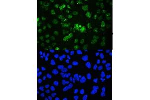 IF analysis of YY1 using anti-YY1 antibody (ABIN3044562). (YY1 抗体  (Middle Region))