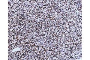 IHC analysis of GLUD1/2 using anti-GLUD1/2 antibody (ABIN7602000). (GLUD1 / GLUD2 (AA 54-553) 抗体)