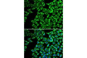 Immunofluorescence analysis of  cells using LIPC antibody (ABIN6131783, ABIN6143250, ABIN6143251 and ABIN6217533). (LIPC 抗体  (AA 280-499))