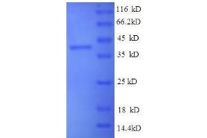 HLA Class I Histocompatibility Antigen, alpha Chain G (HLAG) (AA 25-337), (partial) protein (GST tag) (HLAG Protein (AA 25-337, partial) (GST tag))
