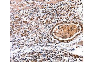 Immunohistochemistry (IHC) image for anti-DNA (Cytosine-5-)-Methyltransferase 3 alpha (DNMT3A) antibody (ABIN1872325) (DNMT3A 抗体)