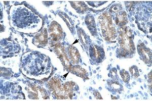 Human kidney; FOXF1 antibody - C-terminal region in Human kidney cells using Immunohistochemistry (FOXF1 抗体  (C-Term))