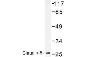 Image no. 2 for anti-Claudin 6 (CLDN6) antibody (ABIN317829) (Claudin 6 抗体)