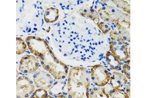 Immunohistochemistry of paraffin-embedded Mouse kidney using COMT Polyclonal Antibody at dilution of 1:100 (40x lens). (COMT 抗体)