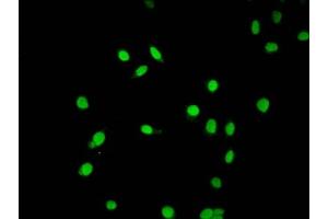 Immunofluorescence staining of Hela cells (treated with 30mM sodium butyrate for 4h) with ABIN7139203 at 1:5, counter-stained with DAPI. (HIST1H2AG 抗体  (acLys9))
