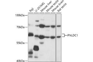 Western blot analysis of extracts of various cell lines, using PNLDC1 antibody (ABIN7269447) at 1:1000 dilution. (PNLDC1 抗体  (AA 200-500))