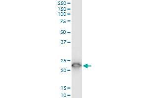 Western Blotting (WB) image for anti-Tumor Protein, Translationally-Controlled 1 (TPT1) (AA 35-138) antibody (ABIN521072)
