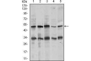 Western blot analysis using CHGA mouse mAb against MOLT4 (1), SK-N-SH (2), HepG2 (3), PC-12 (4), and C6 (5) cell lysate. (Chromogranin A 抗体  (AA 87-252))