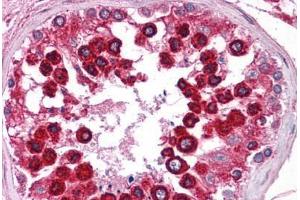 Human Testis: Formalin-Fixed, Paraffin-Embedded (FFPE)