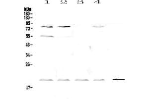 Western blot analysis of CD59 using anti-CD59 antibody . (CD59a 抗体  (AA 24-96))