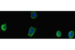 Immunofluorescent analysis of MCF-7 cells using ABIN7173921 at dilution of 1:100 and Alexa Fluor 488-congugated AffiniPure Goat Anti-Rabbit IgG(H+L) (TP53INP2 抗体  (AA 100-220))