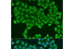 Immunofluorescence analysis of U2OS cells using ATP5O Polyclonal Antibody at dilution of 1:100. (ATP5O 抗体)