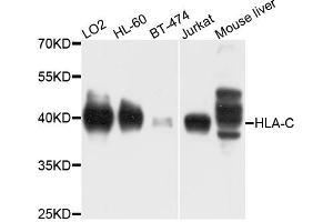 Western blot analysis of extracts of various cell lines, using HLA-C antibody (ABIN4903930) at 1:1000 dilution. (HLA-C 抗体)