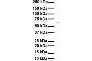 WB Suggested Anti-SNRP70 antibody Titration: 1 ug/mL Sample Type: HEK293 (SNRNP70 抗体  (N-Term))
