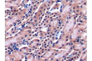 DAB staining on IHC-P; Samples: Mouse Kidney Tissue (LY9 抗体  (AA 384-642))