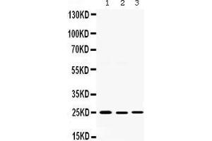 Western blot analysis of Smac/Diablo expression in rat testis extract (lane 1), 22RV1 whole cell lysates (lane 2) and SKOV whole cell lysates (lane 3).