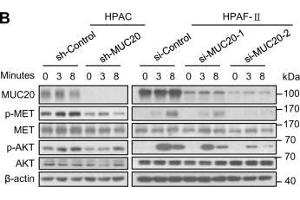 Western Blotting (WB) image for anti-Met Proto-Oncogene (MET) (C-Term) antibody (ABIN2854819)
