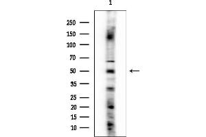 anti-Tachykinin Receptor 3 (TACR3) (C-Term) antibody