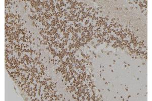 ABIN6276925 at 1/100 staining Rat brain tissue by IHC-P. (HSPA1L 抗体  (Internal Region))