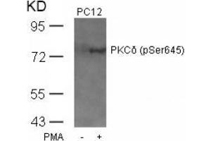 Image no. 2 for anti-Protein Kinase C, delta (PKCd) (pSer645) antibody (ABIN197068)