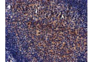 Image no. 4 for anti-Makorin Ring Finger Protein 1 (MKRN1) antibody (ABIN1499486)