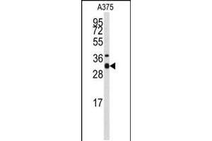 Western blot analysis of anti-STX3 Antibody in A375 cell line lysates (35ug/lane)