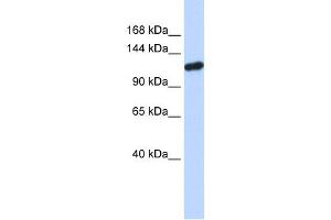 PIWIL4 antibody used at 1 ug/ml to detect target protein. (PIWIL4 抗体)