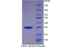 SDS-PAGE analysis of Rat Artemin Protein. (ARTN 蛋白)