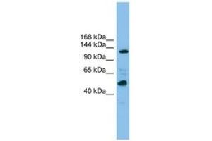 Image no. 1 for anti-Polymerase (RNA) I Polypeptide B, 128kDa (POLR1B) (AA 1007-1056) antibody (ABIN6744853) (POLR1B 抗体  (AA 1007-1056))