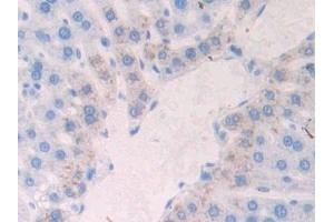 Detection of NCAD in Rat Liver Tissue using Polyclonal Antibody to N-cadherin (NCAD) (N-Cadherin 抗体  (AA 295-414))