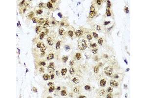 Immunohistochemistry (Paraffin-embedded Sections) (IHC (p)) image for anti-Tet Methylcytosine Dioxygenase 2 (TET2) antibody (ABIN7261632)