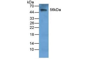 Detection of FGB in Human Liver Tissue using Polyclonal Antibody to Fibrinogen Beta Chain (FGB) (Fibrinogen beta Chain 抗体  (AA 29-491))
