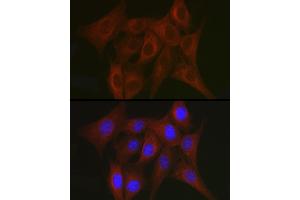 Immunofluorescence analysis of NIH/3T3 cells using TR antibody (ABIN3023477, ABIN3023478, ABIN3023479 and ABIN6220053) at dilution of 1:50. (TRAF7 抗体)
