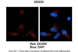 Sample Type :  Human brain stem cells (NT2)   Primary Antibody Dilution :   1:500  Secondary Antibody :  Goat anti-rabbit Alexa Fluor 594  Secondary Antibody Dilution :   1:1000  Color/Signal Descriptions :  Red: DDX3X Blue: DAPI  Gene Name :  DDX3X  Submitted by :  Dr.