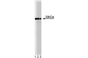Western blot analysis of Jun on human endothelial cell lysate. (C-JUN 抗体  (AA 26-175))