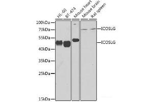 Western blot analysis of extracts of various cell lines using ICOSL Polyclonal Antibody at dilution of 1:1000. (ICOSLG 抗体)